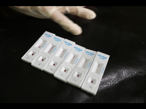 Oms, metà delle diagnosi di Hiv in Europa arriva troppo tardi