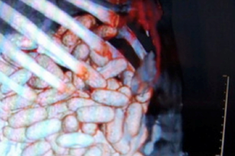 A Malpensa con 98 ovuli di cocaina