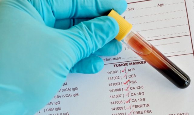 Lotta al cancro, test gratuiti a Varese